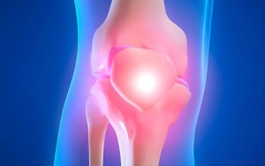 причины развития артроза коленного сустава